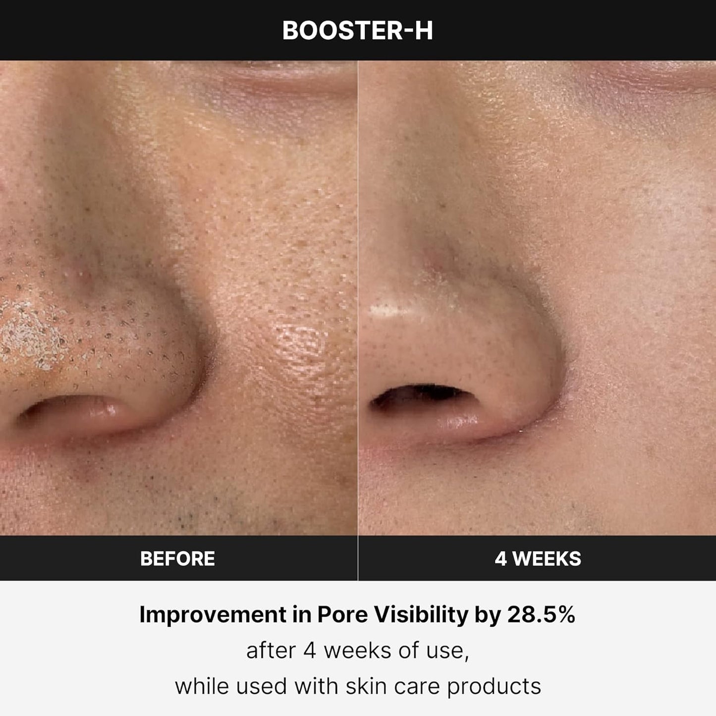 medicube Booster H - Korean Skincare Tool - Facial Glow Booster for Maximizing and Boosting Skin Care Absorption - Needle Free