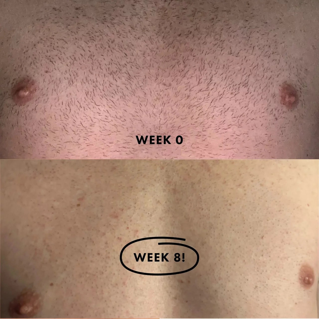 (GREEN) Flasher 2.0 Nood Permanent Painless IPL Laser Hair Removal