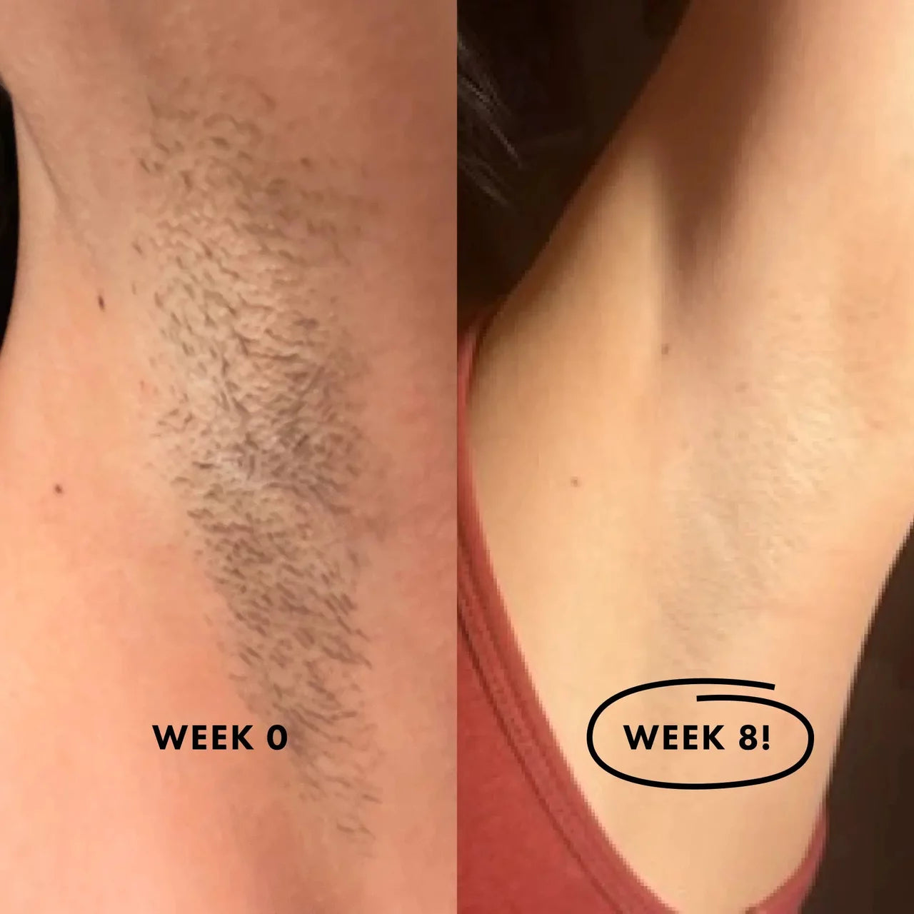 (GREEN) Flasher 2.0 Nood Permanent Painless IPL Laser Hair Removal