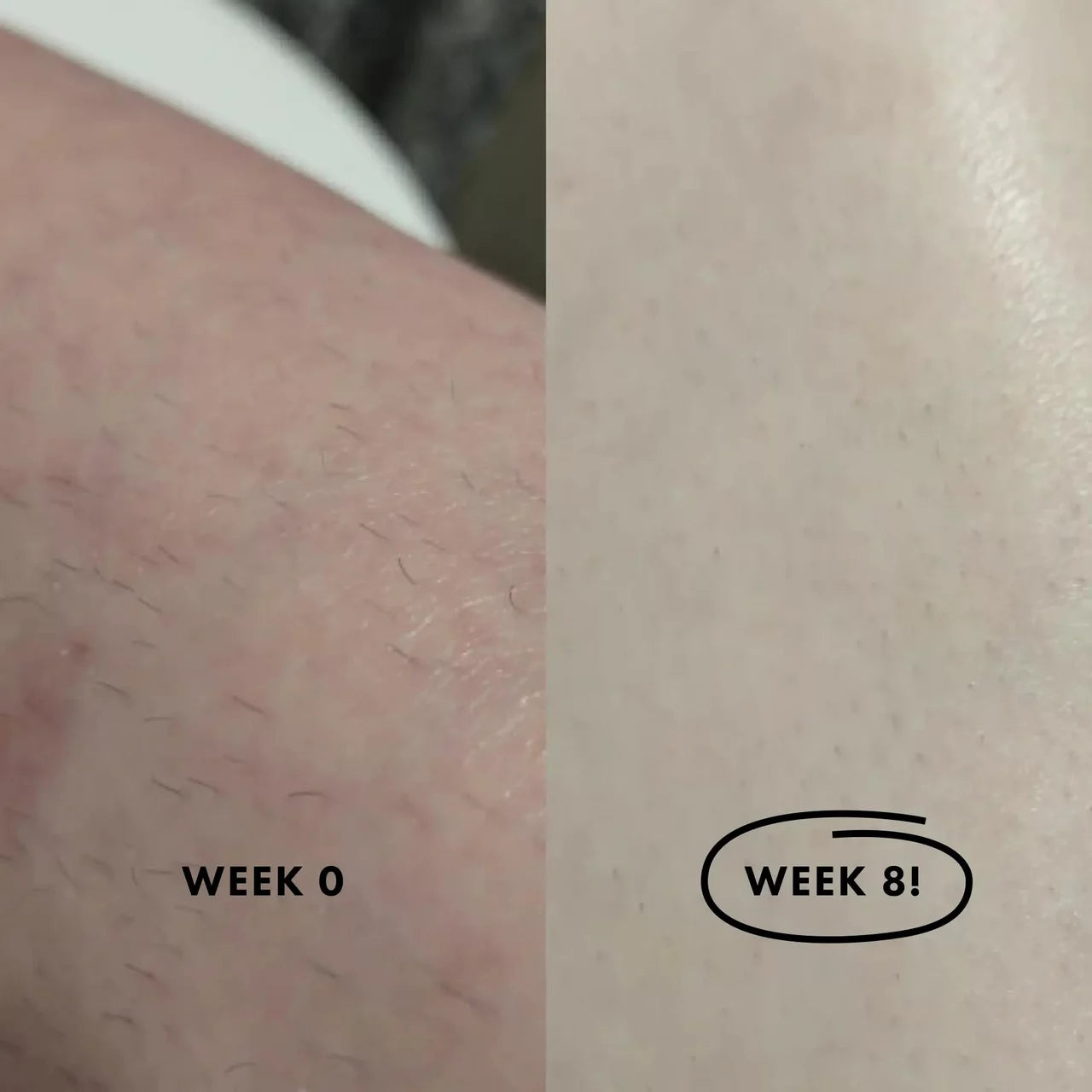 (GREEN) Flasher 2.0 Nood Permanent Painless IPL Laser Hair Removal