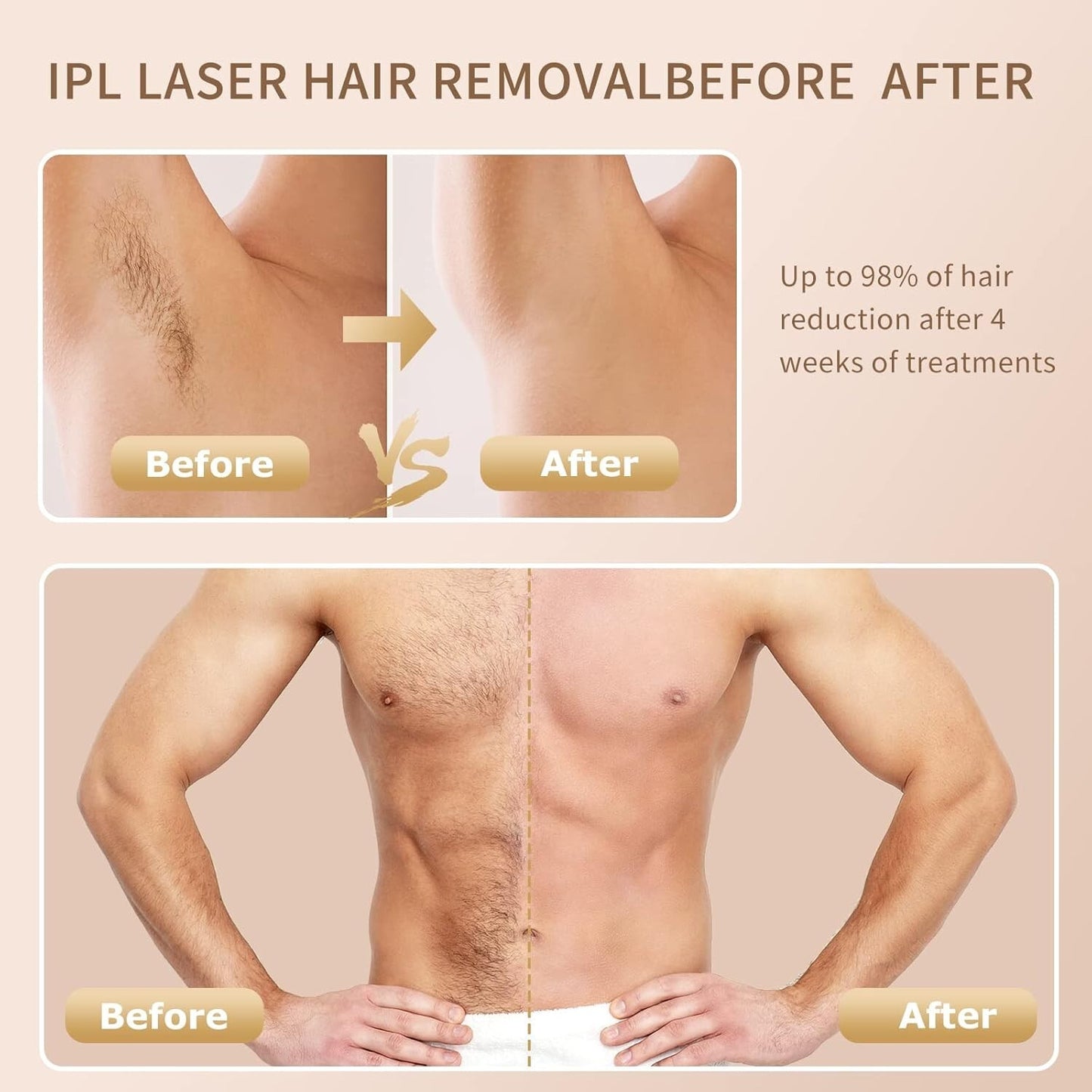 Aopvui Laser Hair Removal Device for Women and Men, 3-in-1 Upgraded 999,900+ Fla