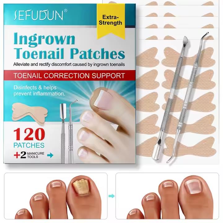 SEFUDUN 120pcs Ingrown Toenail Patches Discomfort Relieving Inflammation Prevent