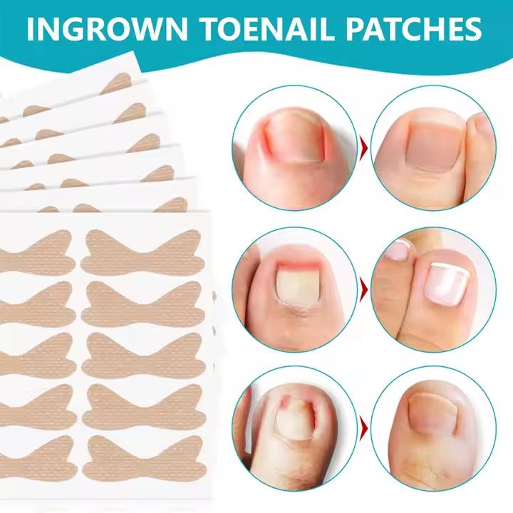 SEFUDUN 120pcs Ingrown Toenail Patches Discomfort Relieving Inflammation Prevent