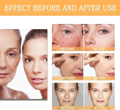 Glycolic Acid Toning Solution Glycolic Acid 7% Toner Glycolic Sour 7% Toning ...