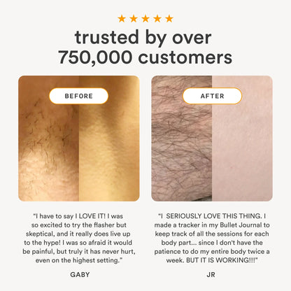 Nood Flasher 2.0 — IPL Laser Hair Removal Device for Women & Men — Pain-Free & Permanent Results