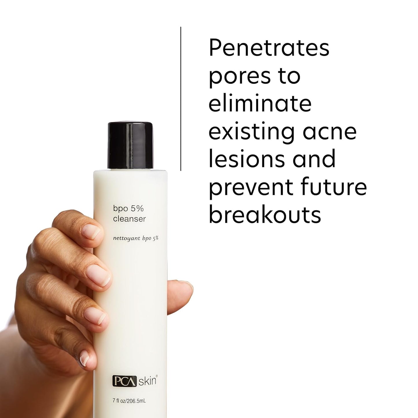 PCA SKIN 5% Benzoyl Peroxide Face Wash, Foaming Acne Facial Cleanser for Oily and Acne Prone Skin, Eliminates Existing Acne and Helps Prevent Future Breakouts, Cleanses and Calms, 7.0 Oz Bottle