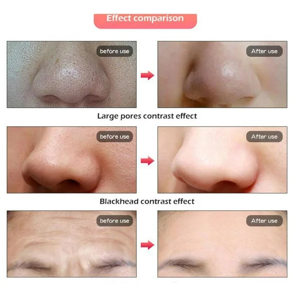 7 for face, anti-aging photon light skin therapy, for facial care with Salvador Portable light facial therapy