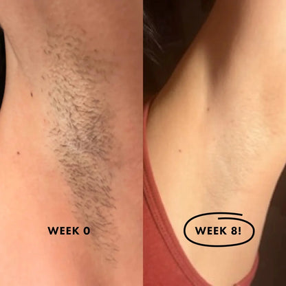 (GREEN) Flasher 2.0 Nood Permanent Painless IPL Laser Hair Removal